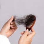 Understanding the Causes of Hair Loss