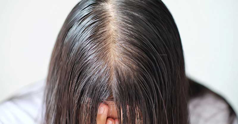 difference between dry and oily scalp